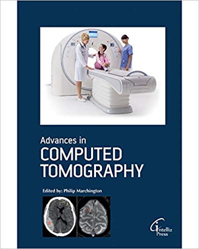 Advances in Computed Tomography