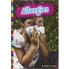 Allergies